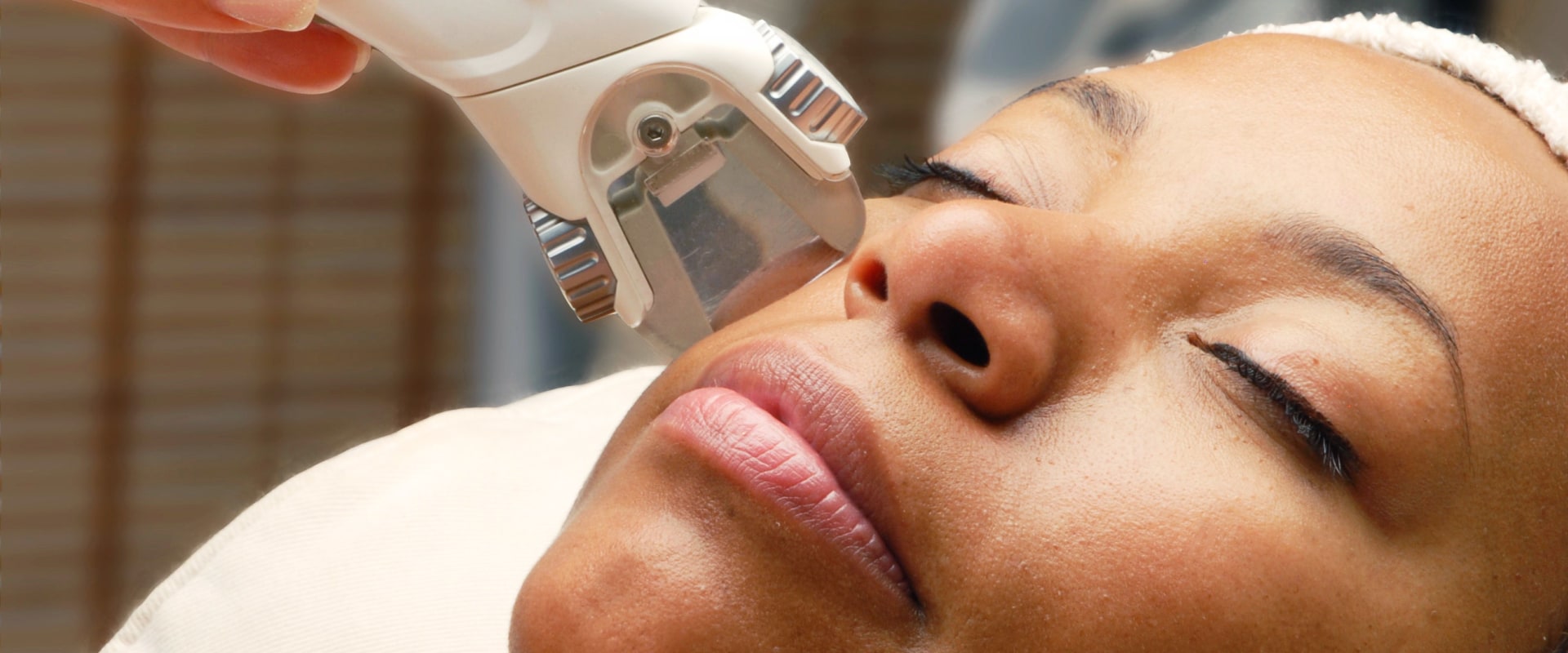 Choosing the Right Type of Laser for Dark Skin Tones