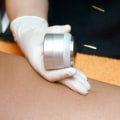 Time Needed for Laser Hair Removal Treatments