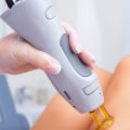Payment Plans and Financing for Laser Hair Removal