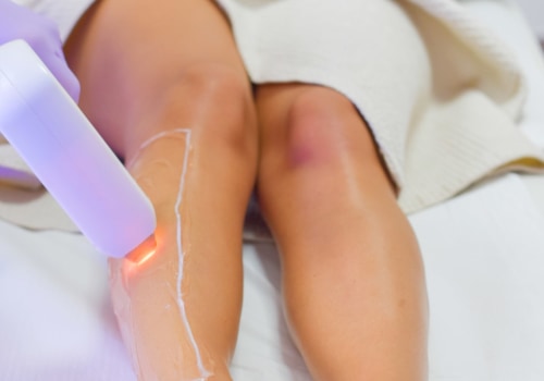 Increased Self-Esteem: The Psychological Benefits of Laser Hair Removal