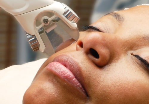 Laser Hair Removal Treatments for the Face and Neck