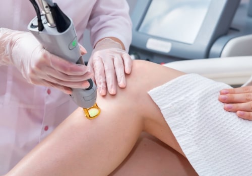 Maintaining a Sterile Environment During Laser Hair Removal Treatments