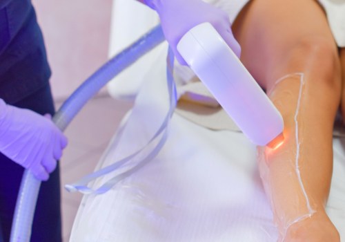 Insurance Coverage for Laser Hair Removal: Everything You Need to Know