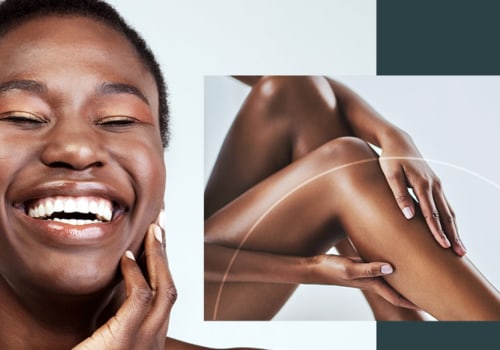 Reducing Risks and Side Effects of Laser Hair Removal for Dark Skin